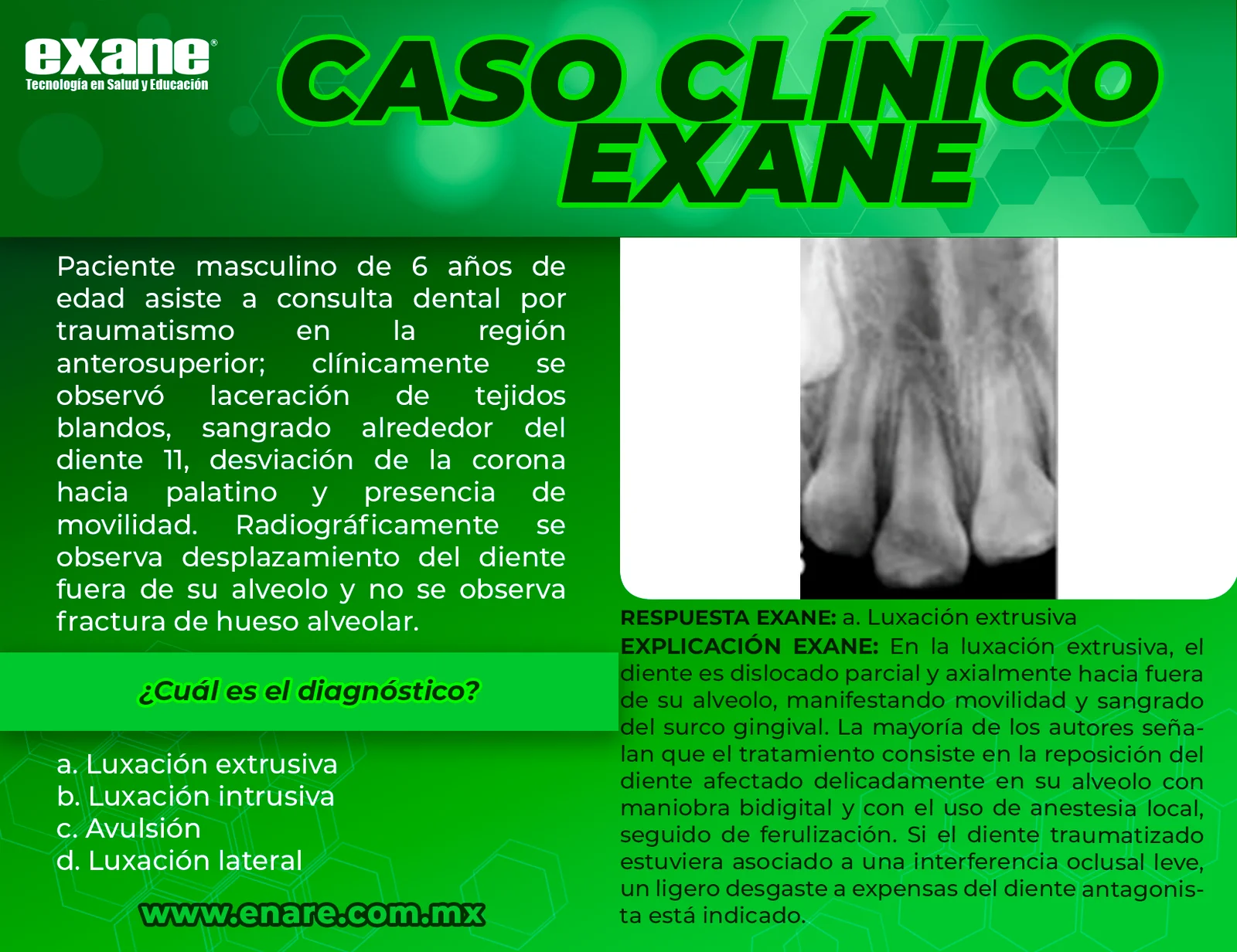 Luxacion-extrusiva-CON-RESPUESTA
