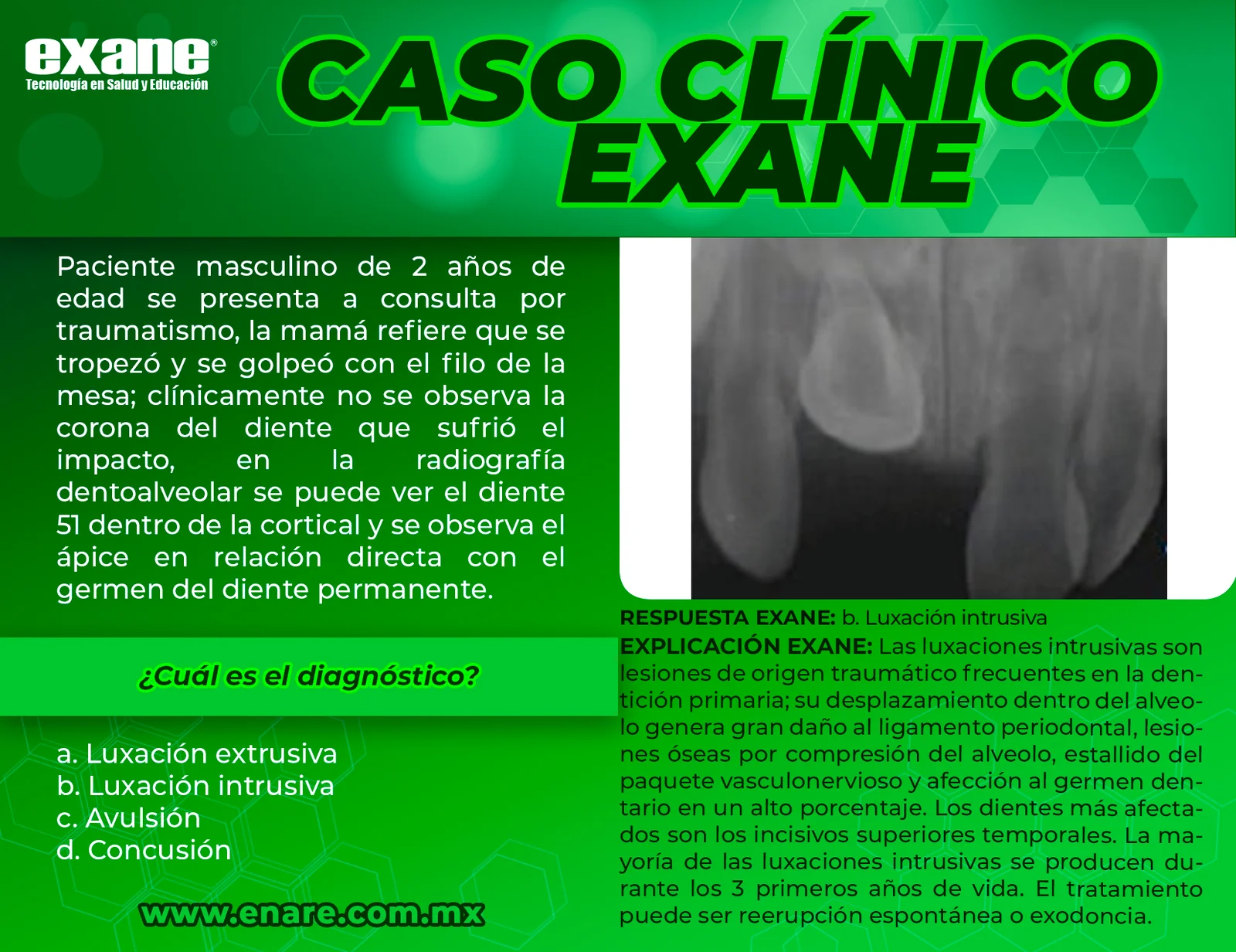 Luxacion-intrusiva-CON-RESPUESTA-1